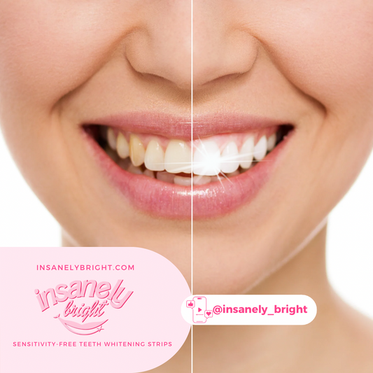 Teeth Whitening Strips (14 day treatment)